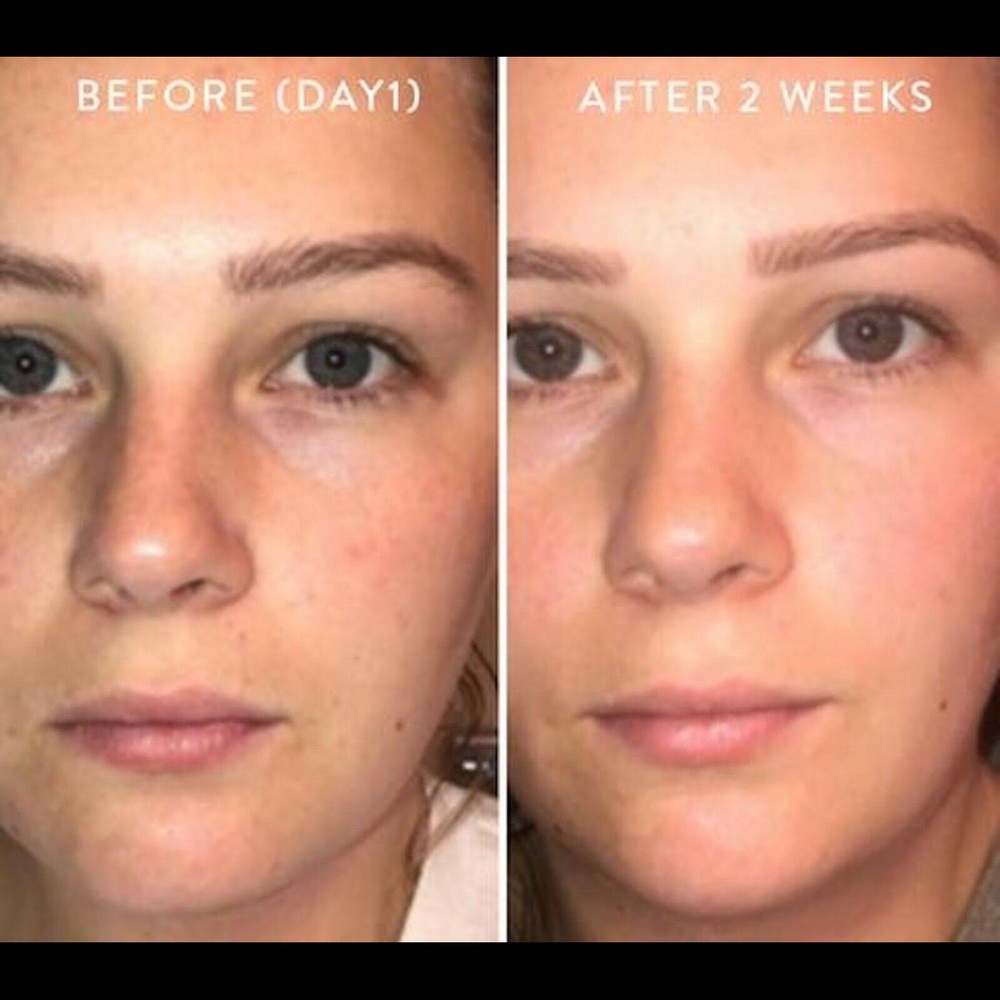 Peach and Lily Glass Skin Refining Serum - Picture 4 of 5